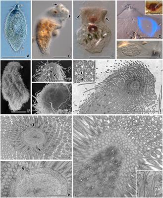 New insights into the coevolutionary history of termites and their gut flagellates: Description of Retractinympha glossotermitis gen. nov. sp. nov. (Retractinymphidae fam. nov.)